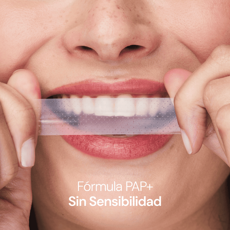 Kit Smile + Limpieza Dental Profunda
