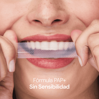 Kit Smile + Limpieza Dental Profunda